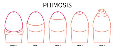 uncircumcised tranny|Shown Actual Size: A Penis Shape & Size Lowdown